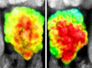 Smell experience during critical period alters brain