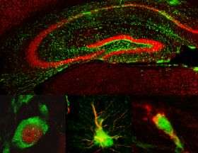 Stem cells can improve memory after brain injury