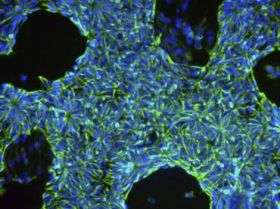 Stem cells show power to predict disease, drug toxicity