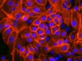 Team finds way to create cancer stem cells