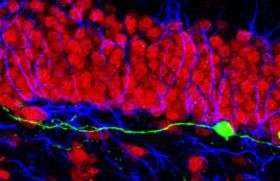 Newborn Neurons in the Adult Brain Can Settle in the Wrong Neighborhood