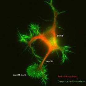 Researchers map signaling networks that control neuron function