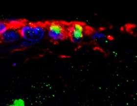Adult stem cells activated in mammalian brain