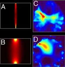 Researcher Finds Early Photon Imaging Detects Lung Cancer 
