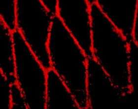 Researchers use magnetism to target cells to animal arteries
