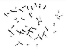 Human Chromosomes under the microscope