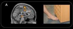 Accidental Pain Prompts Brain Response