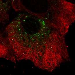 By imaging live cells, researchers show how hepatitis C replicates
