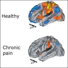 Boom and bust  Chronic pain and brain injury