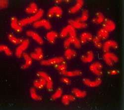 Eroded telomeres are behind a rare premature aging syndrome