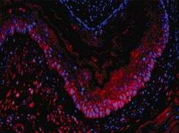 Newly discovered esophagus stem cells grow into transplantable tissue