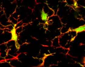 First evidence of native dendritic cells in brain