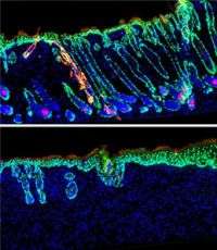 Protein maintains cross talk between cells that control hair growth