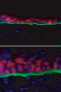 Short RNA strand helps exposed skin cells protect body from bacteria, dehydration and even cancer