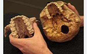 The skull of Paranthropus boisei