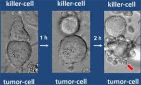 Tumor Cell Under Attack