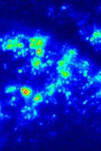 Fluorescence Microscopy with Silver Nanoparticles