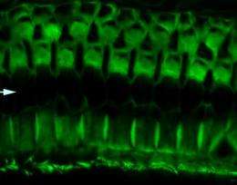 Gene discovery reveals a critical protein's function in hearing