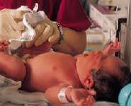 Resuscitated newborns at risk for lower IQs