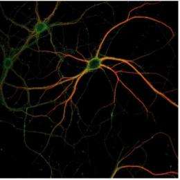 Scientists discover how the brain encodes memories at a cellular level