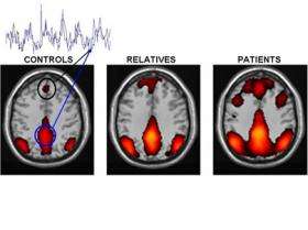 Altered brain activity in schizophrenia may cause exaggerated focus on self
