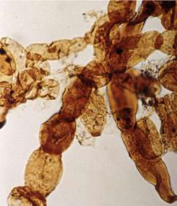 An enlarged image of Reduviasporonites