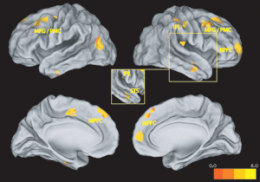 Brain Regions Responsible for Empathy Mapped by Researchers