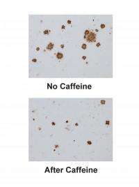 Caffeine reverses memory impairment in Alzheimer's mice