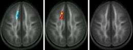 Carnegie Mellon scientists discover first evidence of brain rewiring in children