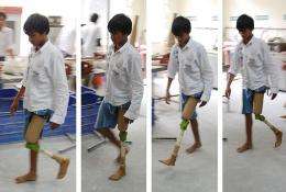 Cool product: $20 artificial knee for patients in the developing world