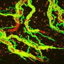 Crossing the line: how aggressive cells invade the brain
