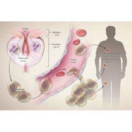 Focal therapy and prostate cancer