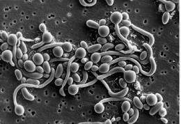 Genetic code cracked of organisms behind fungal disease