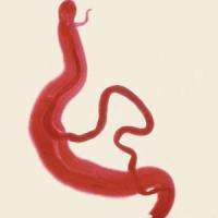 Genomes of parasitic flatworms decoded