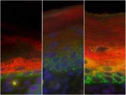 How stem cells make skin
