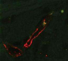 Monocyte in Brain Tissue
