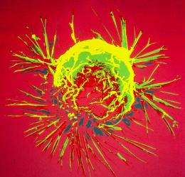 Newly identified genetic variants found to increase breast cancer risk