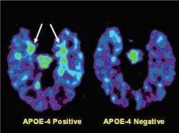 PET Scan for Brain Aging