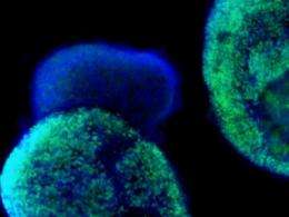 Retina cells grown from skin-derived stem cells