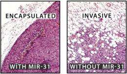 RNA片段抑制侵袭性乳腺癌的蔓延