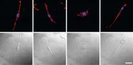 Scorpion venom with nanoparticles slows spread of brain cancer