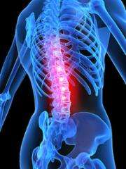 Simple bedside test improves diagnosis of chronic back pain, could guide treatment