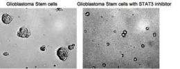 STAT3 gene regulates cancer stem cells in brain cancer