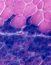 Stem cell surprise for tissue regeneration