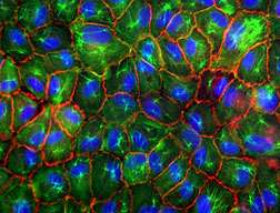 Stiffening arteries could change cell behavior