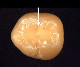 Stronger material for filling dental cavities has ingredients from human body