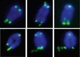 Telomeres resemble DNA fragile sites