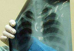 The x-ray machine has revolutionised how doctors detect disease and injury