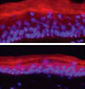 Two proteins enable skin cells to regenerate