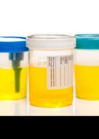 Urine samples could be used to predict responses to drugs, say researchers